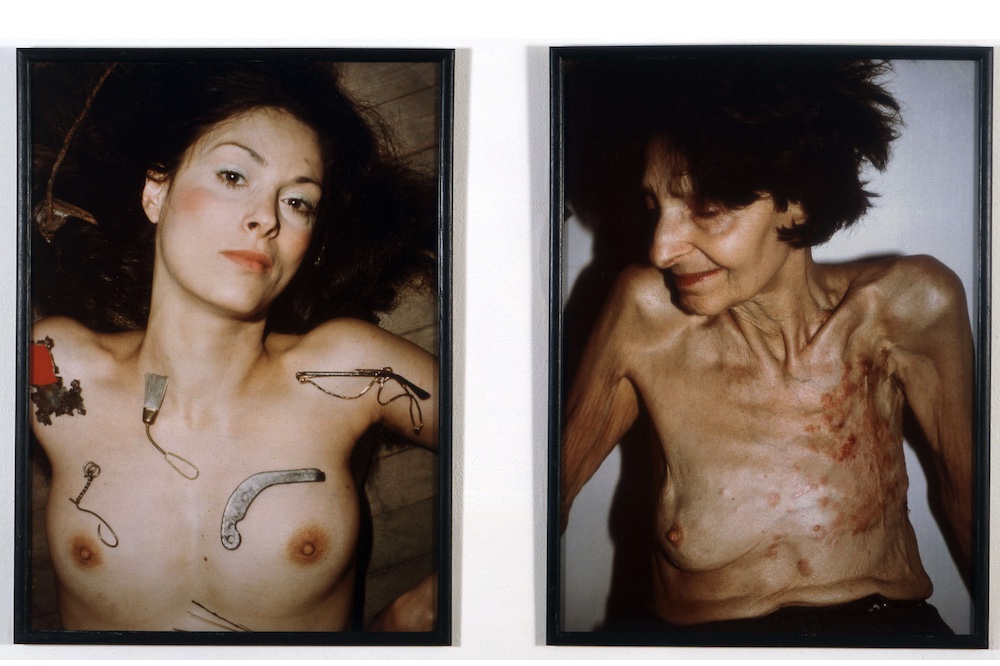 A Meditation on Hannah Wilke’s Last Work