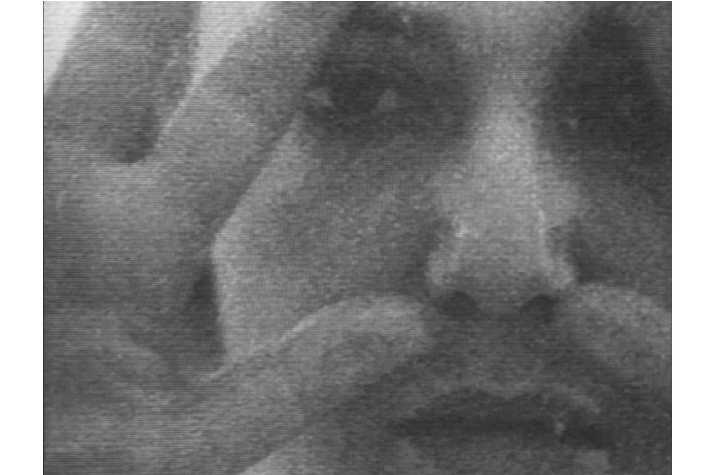 Fought Through Women’s Bodies: Mona Hatoum’s Early Performances